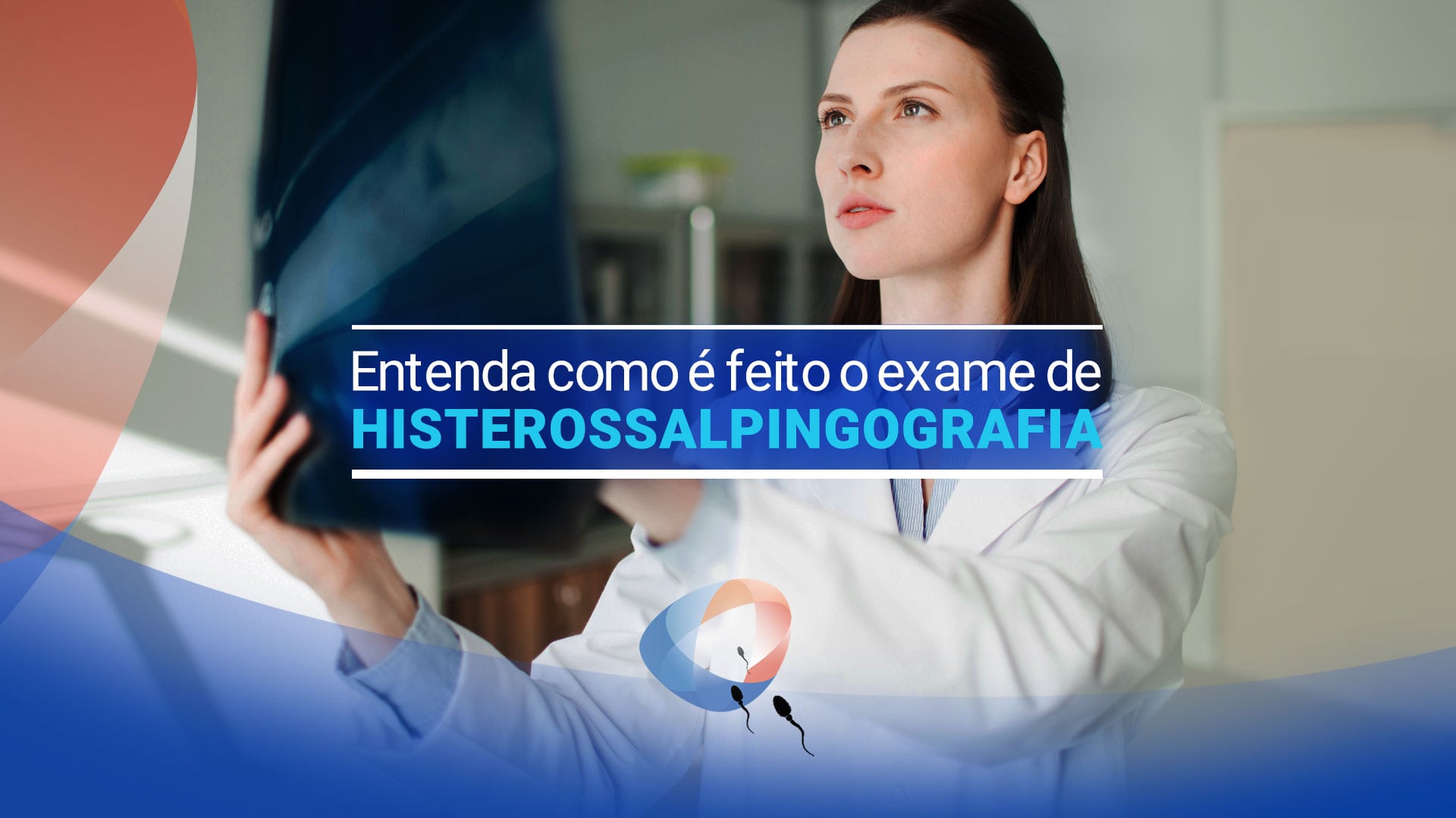 Entenda como é feito o exame de histerossalpingografia