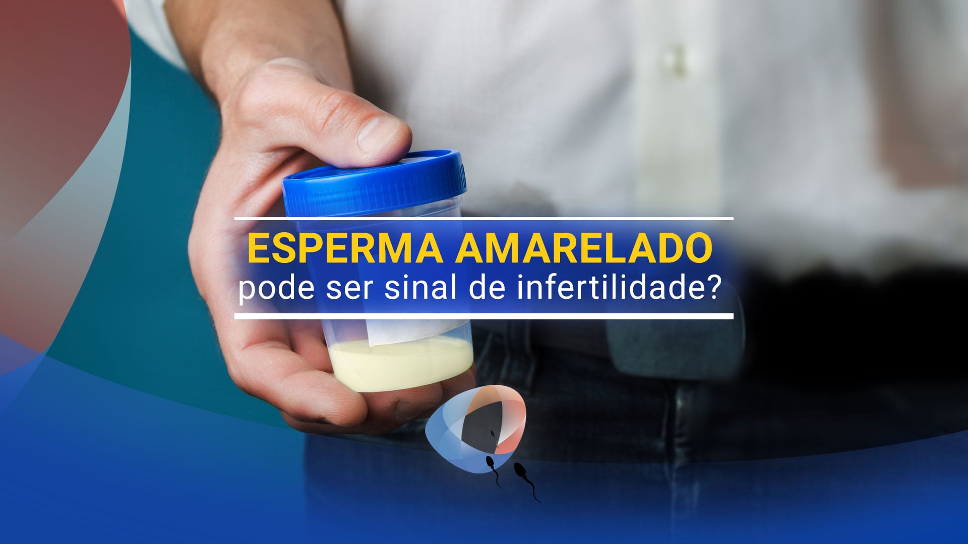 Esperma amarelado pode ser sinal de infertilidade?
