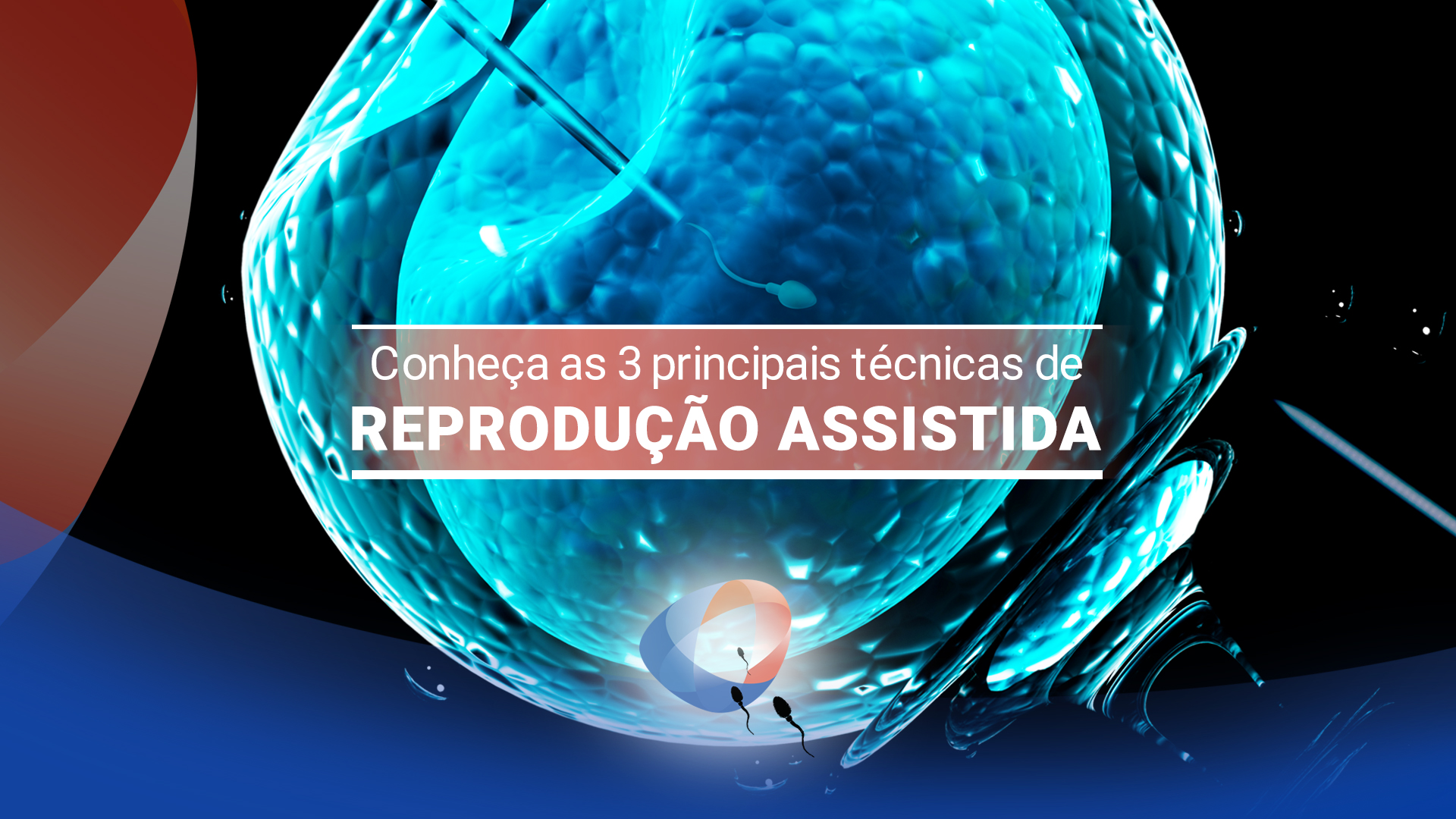 Reprodução assistida: conheça as 3 principais técnicas
