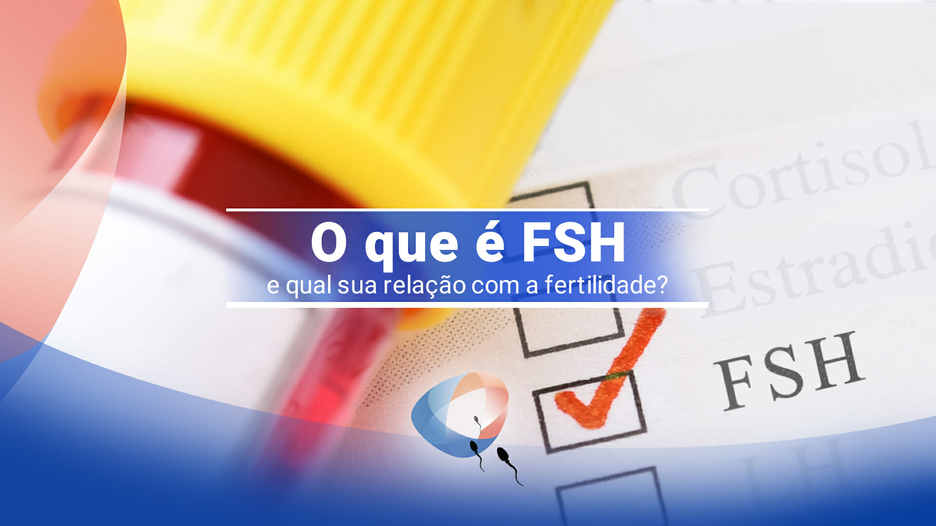 O que é FSH e qual sua relação com a fertilidade?