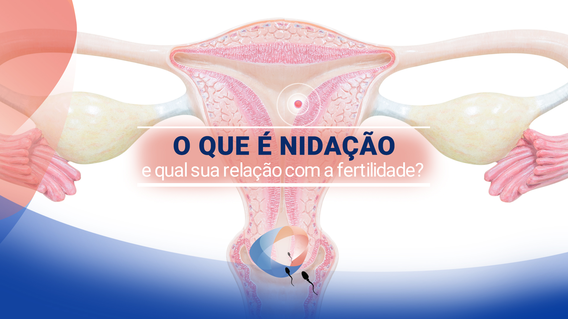 O que é nidação e qual sua relação com a fertilidade?