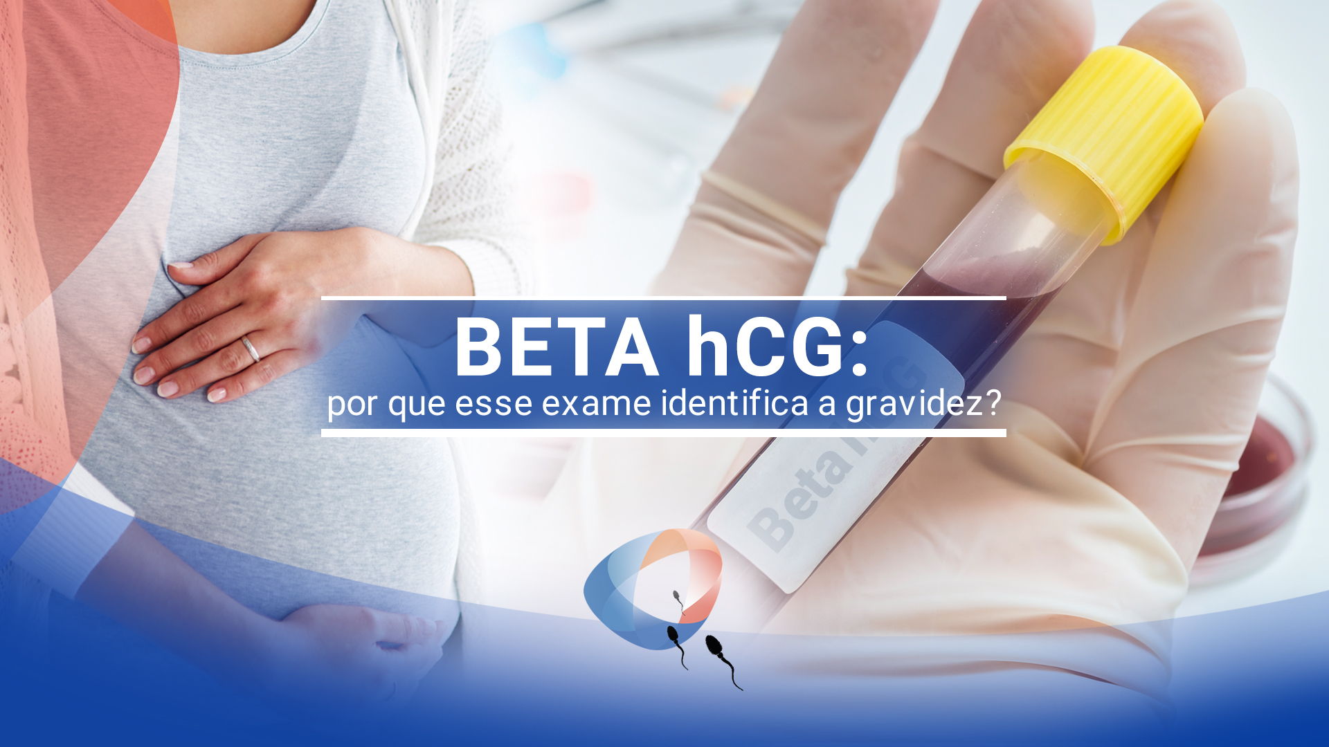 Beta hCG: por que esse exame identifica a gravidez?