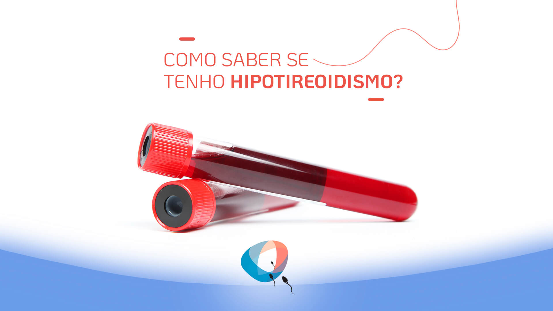 Como saber se tenho hipotireoidismo?